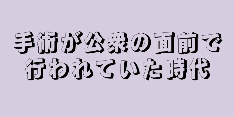 手術が公衆の面前で行われていた時代