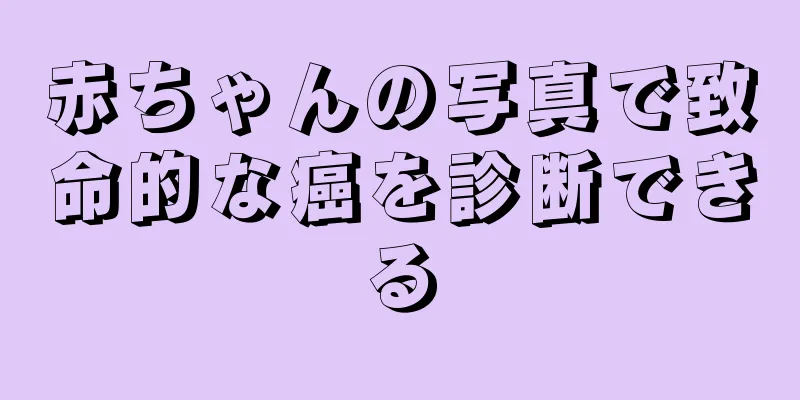 赤ちゃんの写真で致命的な癌を診断できる